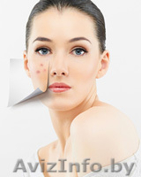 Косметологический кабинет\"Шарми\" - Изображение #3, Объявление #971201